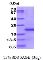 Human CD300E Protein (Recombinant His)