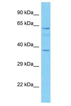 MAP3K7 / TAK1 Antibody (aa418-467)