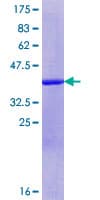 Human CCDC85B Protein (Recombinant GST, N-terminus)