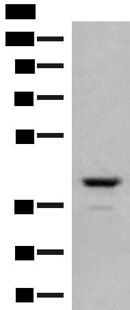 Polyclonal Rabbit anti-Human TAAR2 / GPR58 Antibody (IHC, WB)