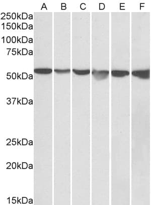IHC-plus™ Polyclonal Goat anti-Human GPI Antibody (aa120-132, IHC, WB)