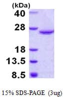 Human DUSP18 Protein (Recombinant His)