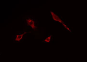 ACTA3 / ACTG2 Antibody