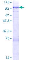 Human ITK / EMT Protein (Recombinant GST)