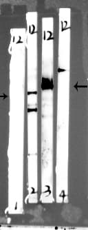 PIK3R1 / p85 Alpha Antibody (phospho-Tyr607)