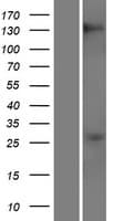 Human RBM20 Protein (Over-Expression Lysate Myc-DDK (Flag))