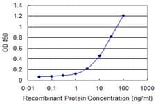 PEAK1 / SGK269 Antibody (clone 3F9)