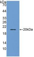 ADM / Adrenomedullin Antibody (aa22-147)