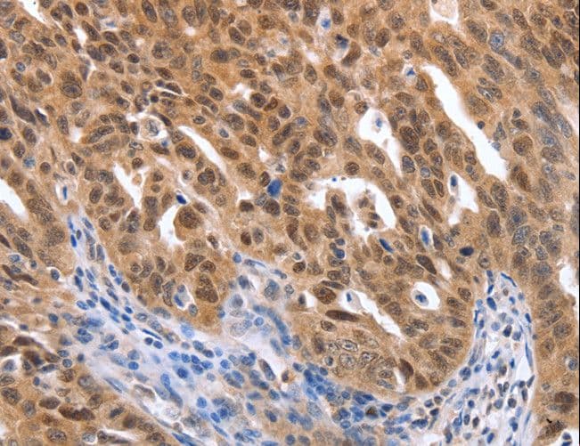 MAP2K1 / MKK1 / MEK1 Antibody