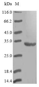 Staphylococcus haemolyticus DHPS Protein (Recombinant 6His, N-terminus)