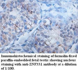 ZNF331 Antibody (aa75-352)