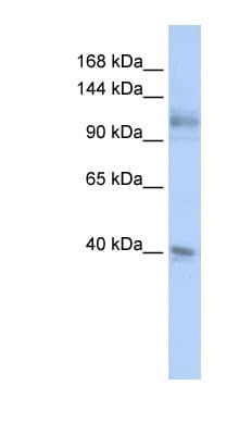 MSH2 Antibody (aa108-157)