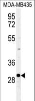 FBXL15 Antibody (aa252-280)