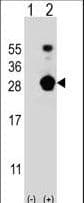 Polyclonal Rabbit anti-Human FKBP7 Antibody (aa195-224, IHC, WB)