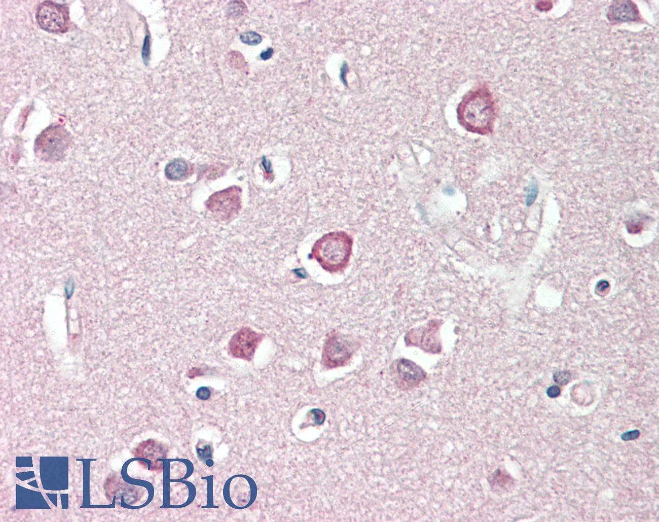 IHC-plus™ ENPP2 / Autotaxin Antibody (aa698-712)