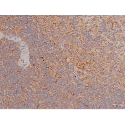 Polyclonal Rabbit anti-Human SP1 Antibody (phospho-Thr739, IHC, IF, WB)