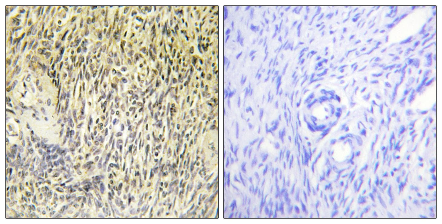 SYK Antibody (Ab-323)