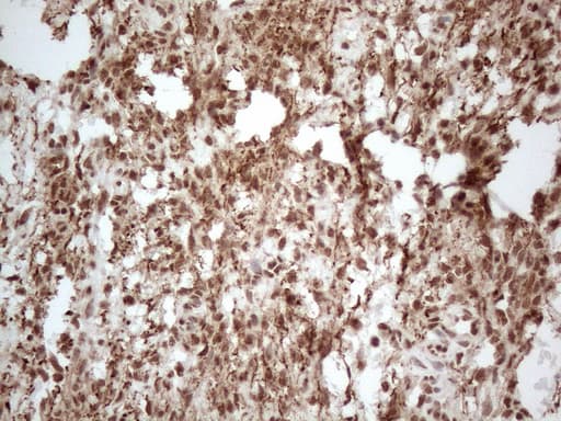 IRS1 Antibody (aa1-280, clone OTI3G10, Carrier-free)