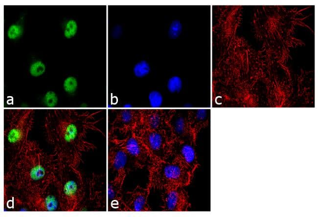 CSNK1E / CK1 Epsilon Antibody (N-Terminus)
