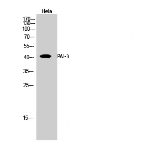 SERPINA5 / PCI Antibody (230-310 aa, Internal)