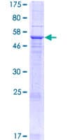 Human MYEOV Protein (Recombinant GST)