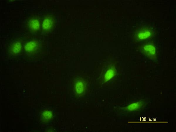 IHC-plus™ CRY1 Antibody (clone 4H4-1C4)