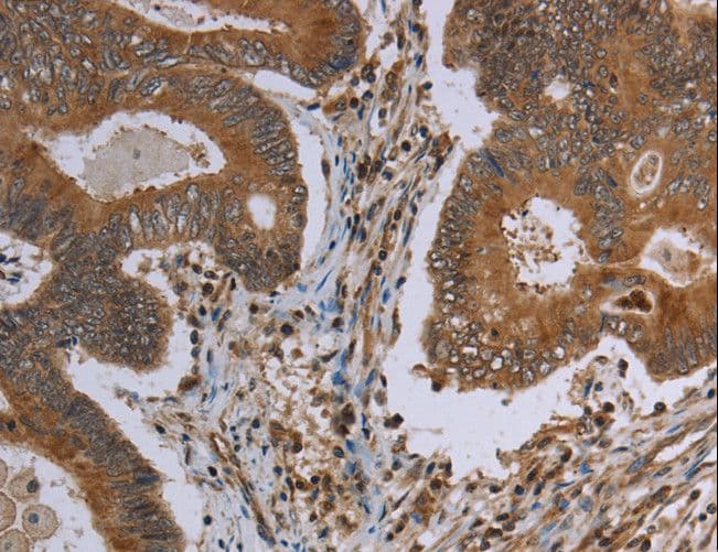 VISA / MAVS Antibody