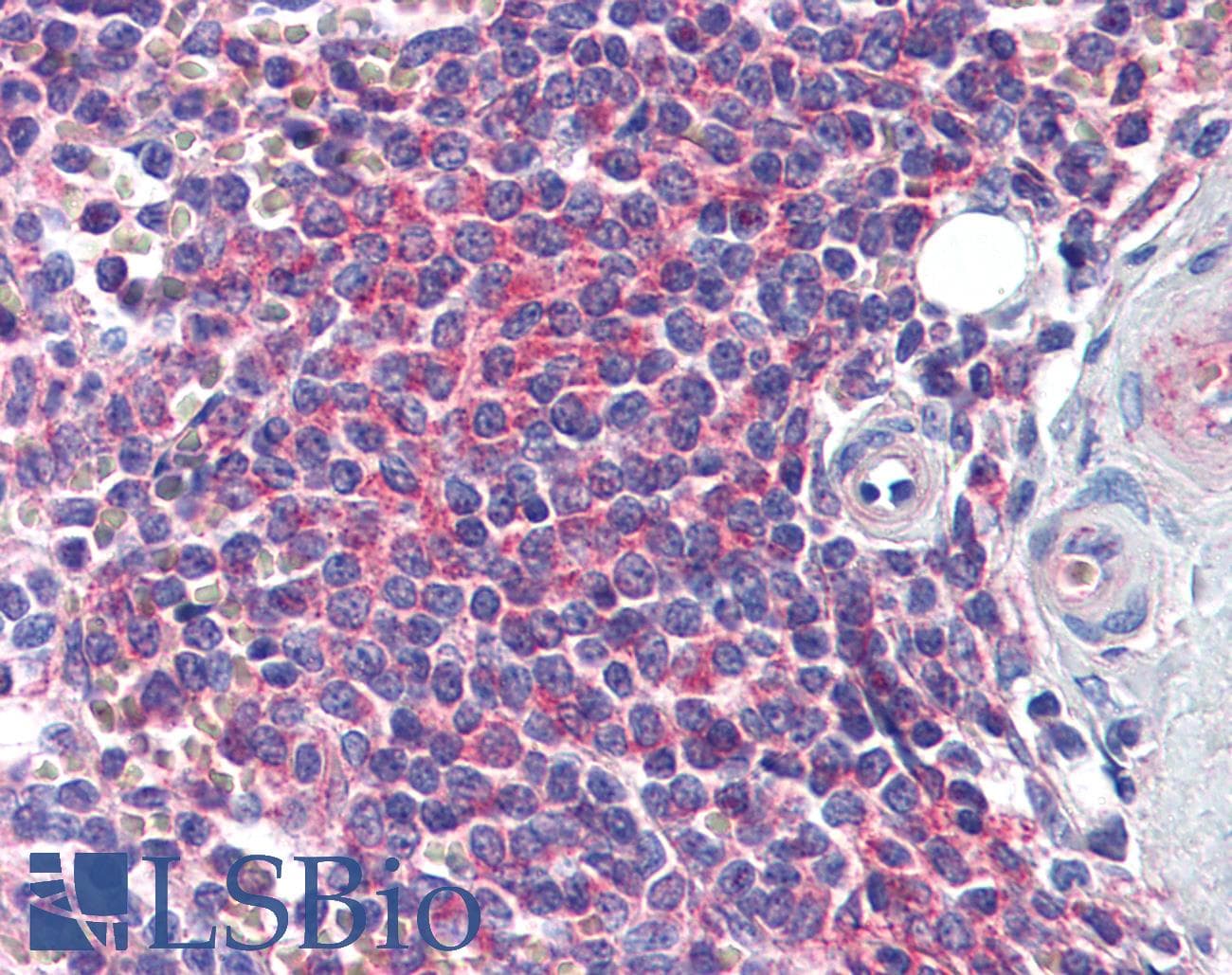 IHC-plus™ HEDLS / EDC4 Antibody (clone 2E2)