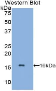 NPHS1 / Nephrin Antibody (aa23-130, PE)