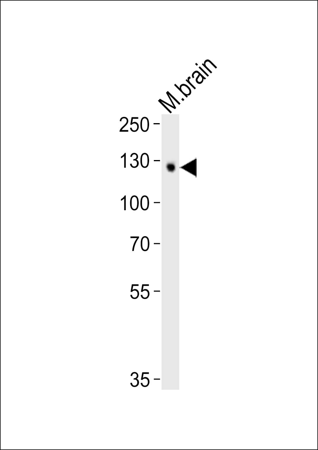 TYRO3 Antibody (clone 1444CT895.86.31)