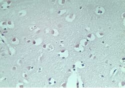 MAP1LC3A / LC3A Antibody (aa1-50)