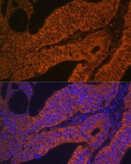 Polyclonal Rabbit anti-Human RAB5B Antibody (IF)