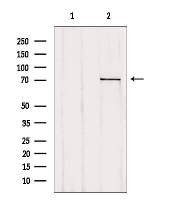 MAC-2-BP / LGALS3BP Antibody