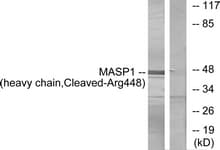 Polyclonal Rabbit anti-Human MASP1 / MASP Antibody (aa399-448, WB)