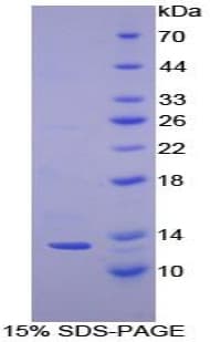 Human CSTA / Cystatin A Protein (Recombinant His)
