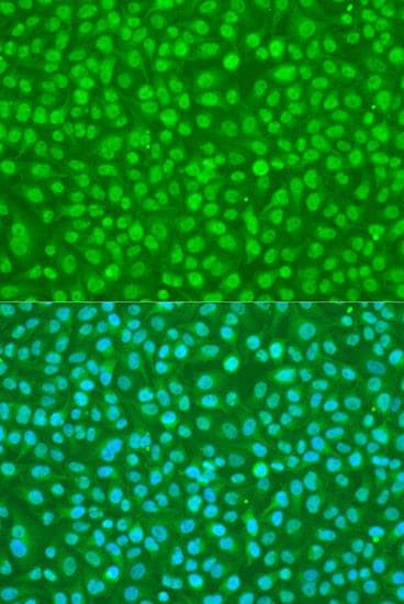 SRSF9 / SFRS9 Antibody