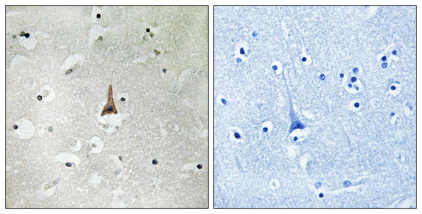LRP10 Antibody
