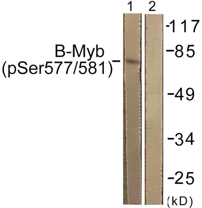 MYBL2 Antibody (phospho-Ser577/581)