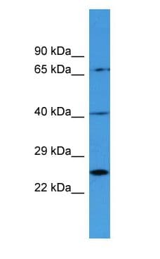 Polyclonal Rabbit anti-Human Complement C1R Antibody (aa141-190, WB)