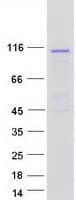 Human FUK Protein (Recombinant Myc-DDK (Flag))
