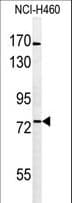 Polyclonal Rabbit anti-Human BBS10 Antibody (aa515-544, WB)