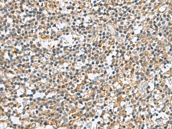Polyclonal Rabbit anti-Human C6orf108 Antibody (IHC, WB)