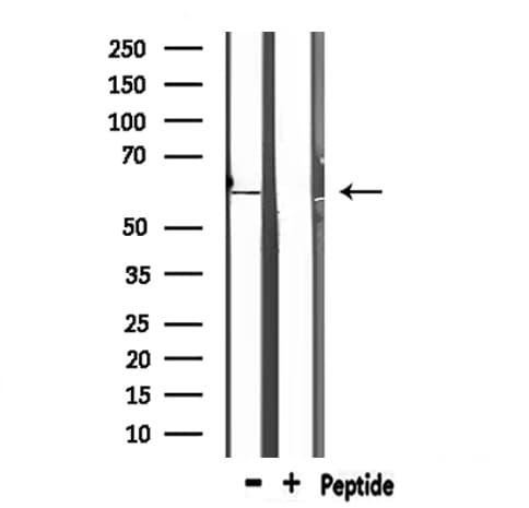 NT5E / eNT / CD73 Antibody