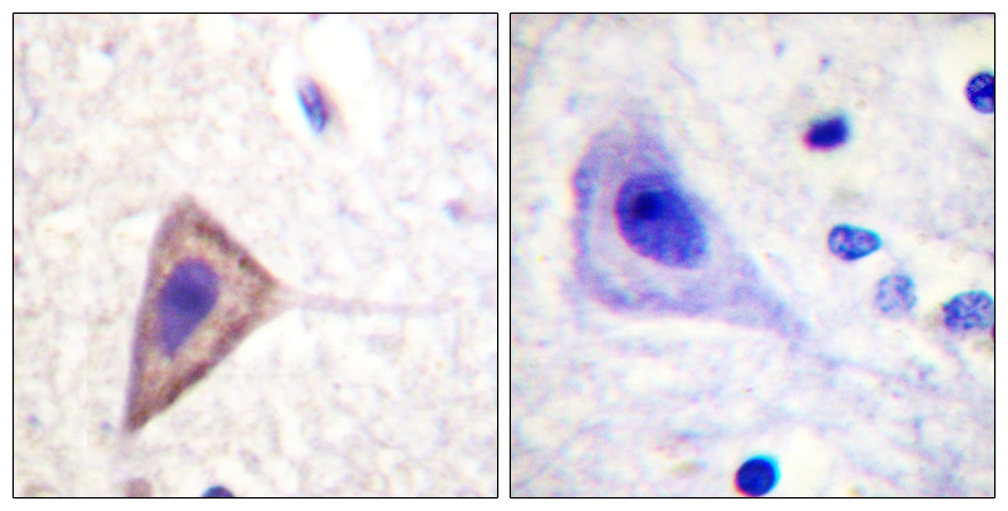 Polyclonal Rabbit anti-Human KCNA3 / Kv1.3 Antibody (aa101-150, IHC, IF)