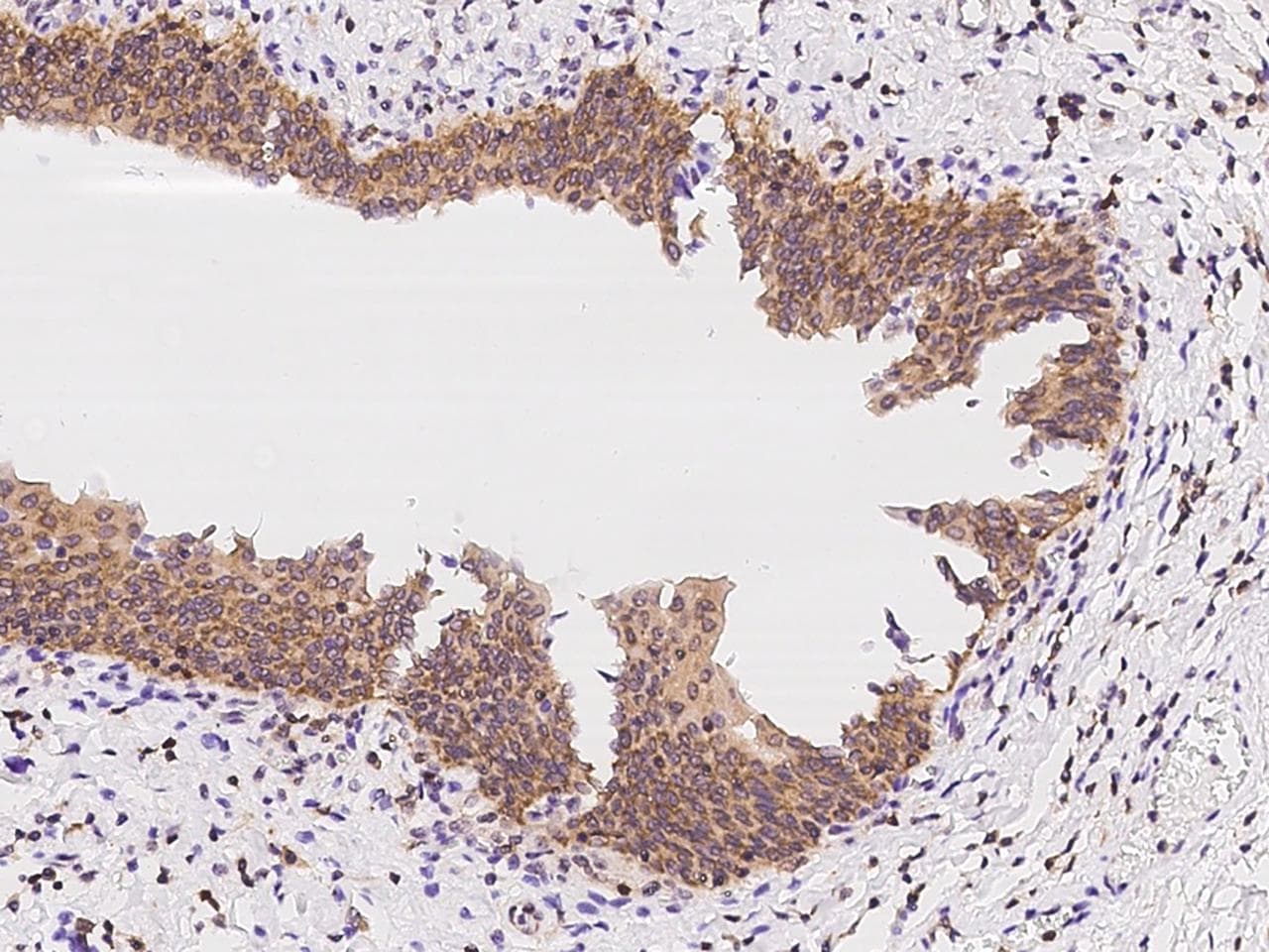 Polyclonal Rabbit anti-Human CACYBP Antibody (IHC, IF, WB)