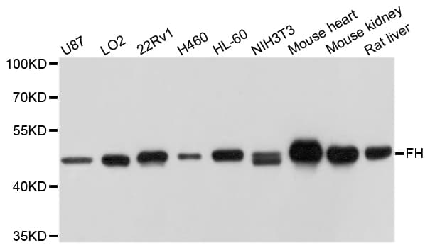 FH / Fumarase / MCL Antibody