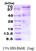 Human IL12 Protein (Recombinant His)