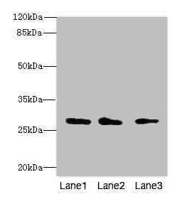CAPNS1 / CAPN4 Antibody