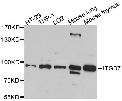 Polyclonal Rabbit anti-Human ITGB7 / Integrin Beta 7 Antibody (WB)