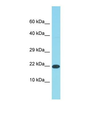 DDIT3 / CHOP Antibody (aa28-77)
